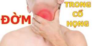 Bị đờm ở cổ họng lâu ngày