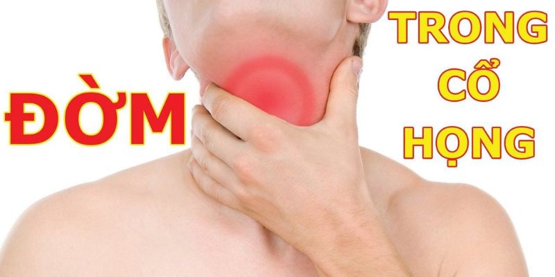 Bị đờm ở cổ họng lâu ngày