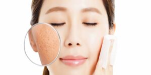 Cách Làm Se Lỗ Chân Lông Trên Mặt Hiệu Quả – Bí Quyết Cho Làn Da Mịn Màng