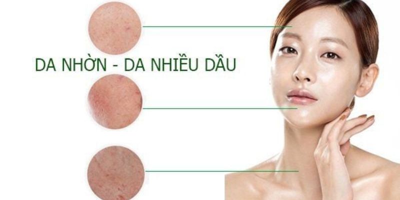 Nguyên Nhân Gây Da Dầu