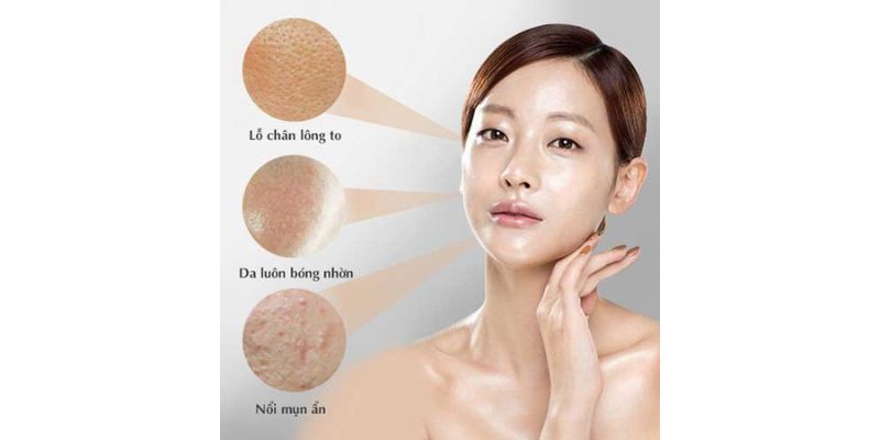 Sử Dụng Sản Phẩm Đặc Trị Kiểm Soát Dầu