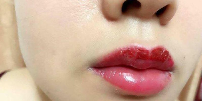 Cách Chăm Sóc Môi Để Bong Nhanh Và Lên Màu Đẹp