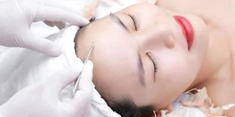 Điều Trị Mụn Bằng Công Nghệ Cao