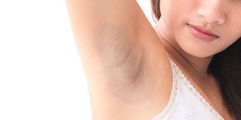 Nguyên Nhân Gây Thâm Nách